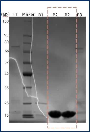 sds-page-detection-2.jpg sds-page-detection-2.jpg