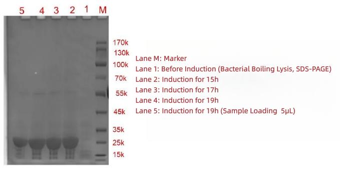 figure-2-induction-electrophoreogram.jpg figure-2-induction-electrophoreogram.jpg