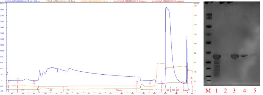 figure-5-left-maxtar-mmc-hr-one-step-purification-profile-right-gel-electrophoresis.jpg figure-5-left-maxtar-mmc-hr-one-step-purification-profile-right-gel-electrophoresis.jpg
